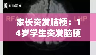 家长突发脑梗：14岁学生突发脑梗 