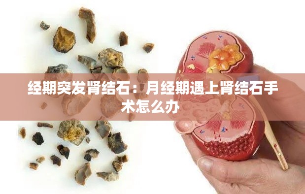 经期突发肾结石：月经期遇上肾结石手术怎么办 